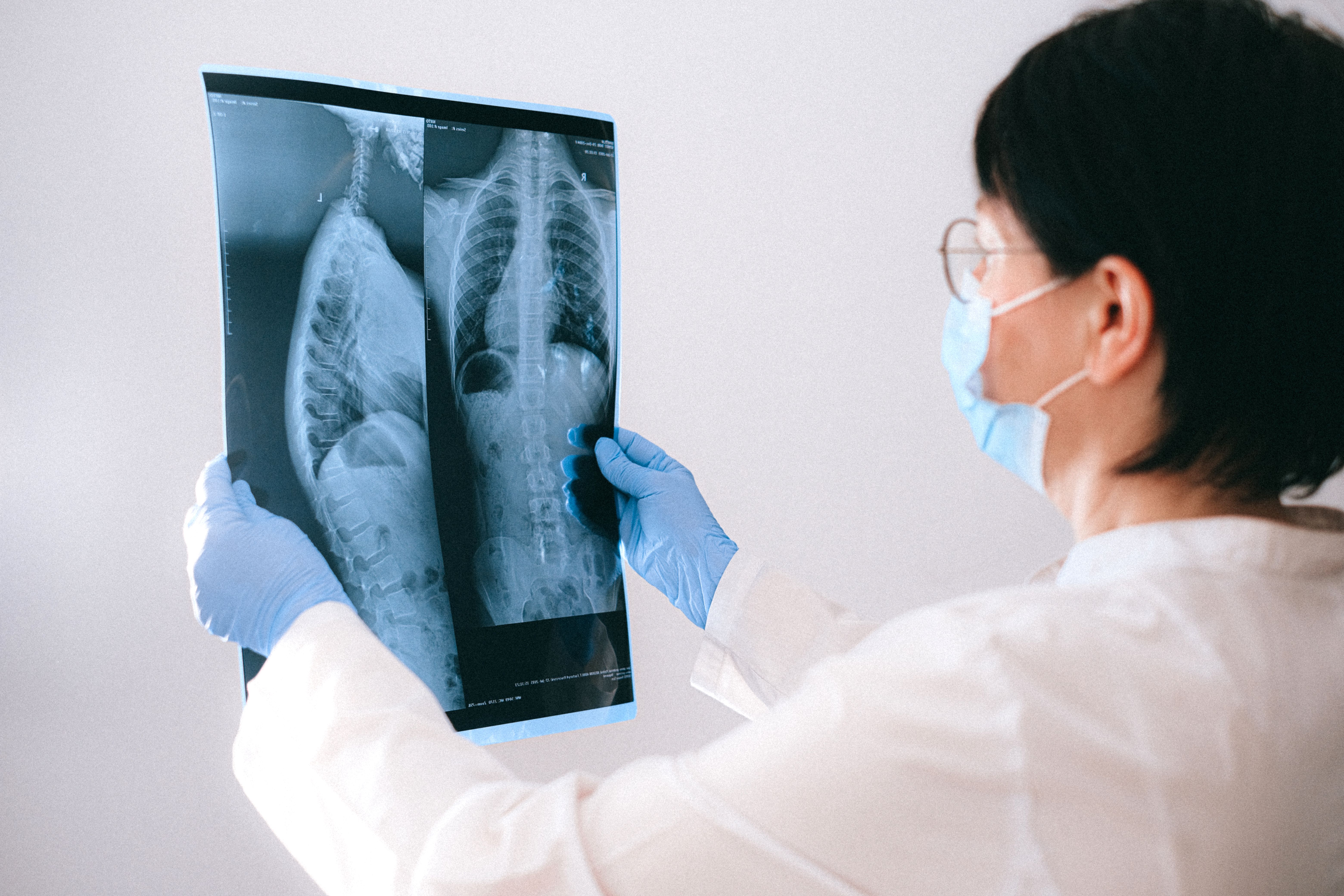 What You Need to Know About Polycystic Kidney Disease